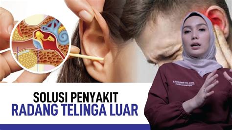 Radang Telinga Luar Gejala Penyebab Dan Cara Mengatasinya Kata