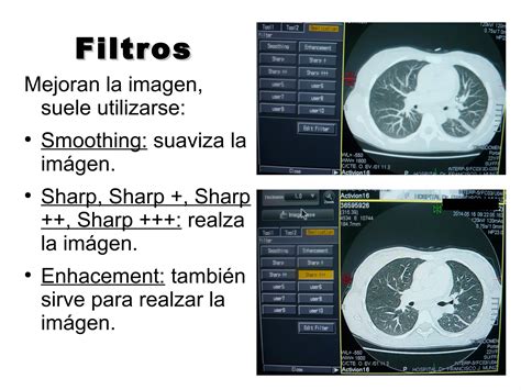 Reconstrucci N En Tc Ppt