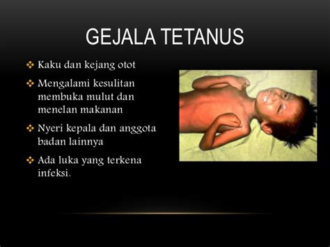 Gejala Penyakit Tetanus Homecare