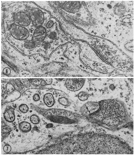 Several Purkinje Cell Dendritic Branchlet Spines Are Seen In This