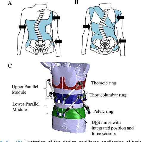 Figure 1 From Robotic Spine Exoskeleton RoSE Characterizing The 3 D