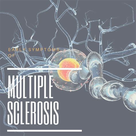 Early Symptoms Of Multiple Sclerosis Premier Neurology Wellness Center