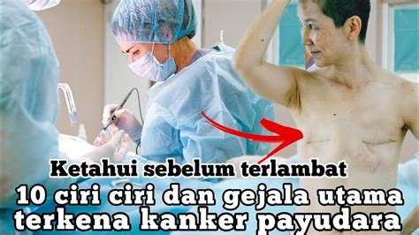 Ciri Ciri Dan Gejala Utama Terkena Kanker Payudara Pahami Sebelum