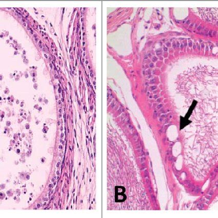 Panoramic View Of A Longitudinal Section Of The Rat Epididymis A