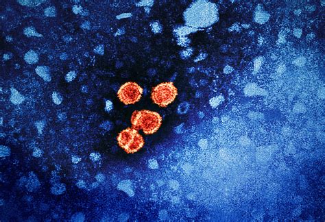 Hepatitis B Virus Colorized Transmission Electron Microgra Flickr