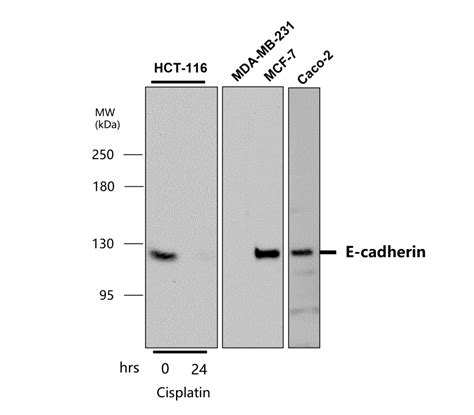 EMT Marker Antibody Panel IRAP5001 IReal Biotechnology Inc