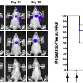 PAR Targeted Radionuclide Therapy With 177Lu DOTA AE105 Inhibits