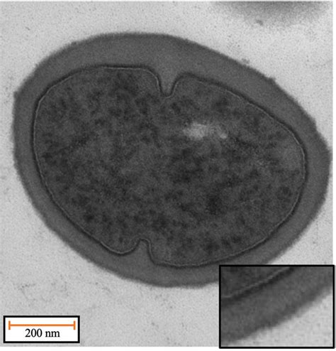 Transmission Electron Microscopy Tem Images Of S Aureus Cells For