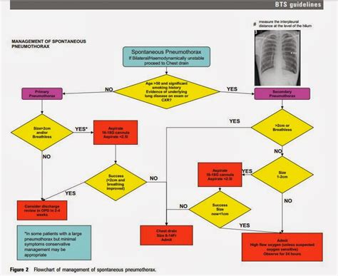 Pneumothorax Management Guidelines 2025 Carmen Elise