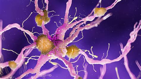 beta amyloid