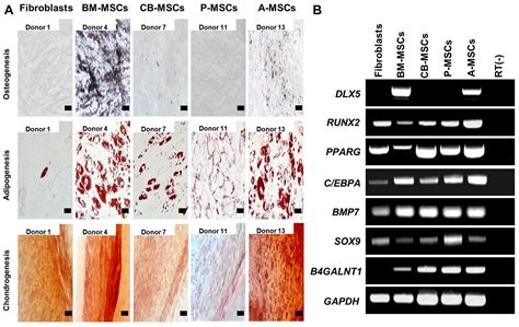 Comparison Of Molecular Profiles Of Human Mesenchymal Stem Cells