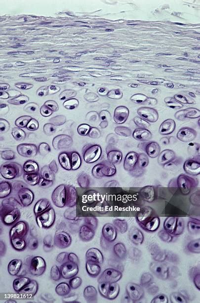 Hyaline Cartilage Connective Tissue Photos And Premium High Res