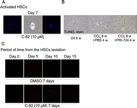 Inhibition Of Cyclic Adenosine Monophosphate CAMP Response Element