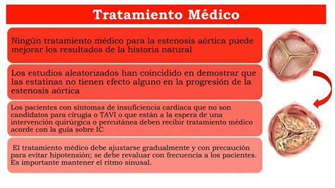 Tratamiento De Estenosis Aortica Ppt