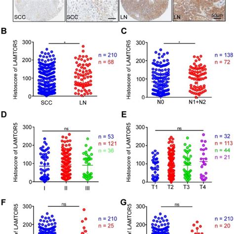 Overexpression Of Lamtor In Primary Hnscc A Representative