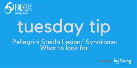 TUESDAY TIP: Pellegrini Stieda Lesion and Syndrome What to Look for on ...