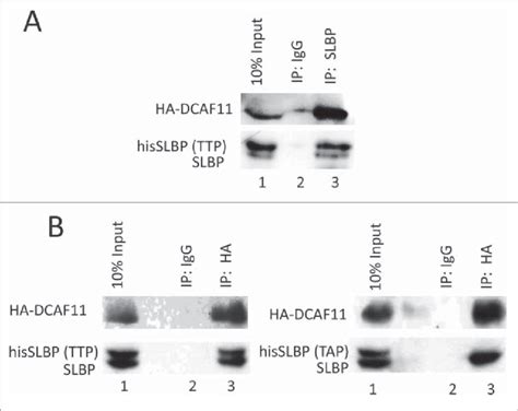 Dcaf11 Interacts With Wild Type But Not Thr 61 Ala Mutant Slbp A