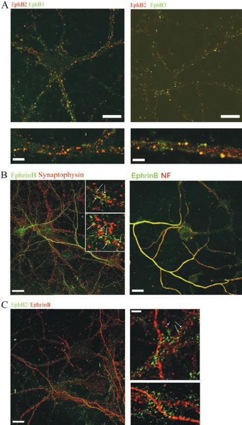 Distribution Of Ephrin B And EphB Receptors In Cultured Hippocampal