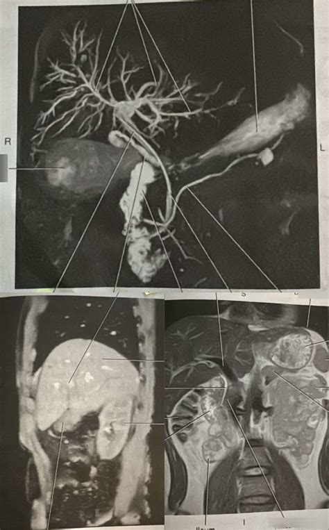 Unit Abdomen Study Guide Diagram Quizlet