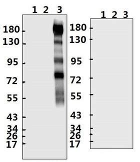 Anti Sars Cov Spike Glycoprotein Antibody Rabbit Polyclonal Lsbio