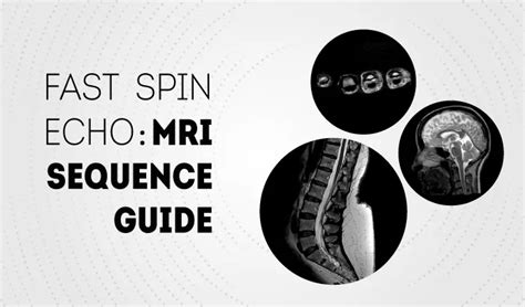 Fast Spin Echo Sequence MRI Sequences Guide