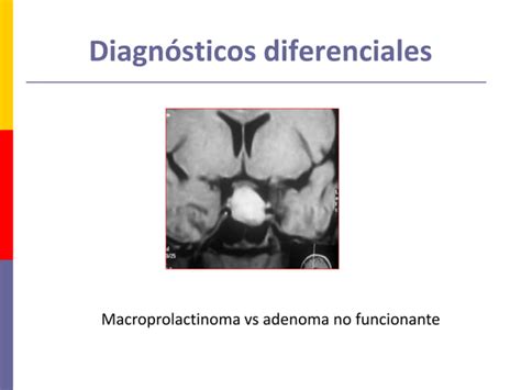 Tumores Funcionantes De Hip Fisis Ppt