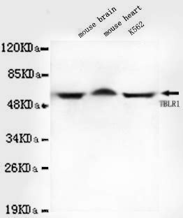 Tblr Antibody Purified Mouse Monoclonal Antibody Mab Wb Icc Ihc