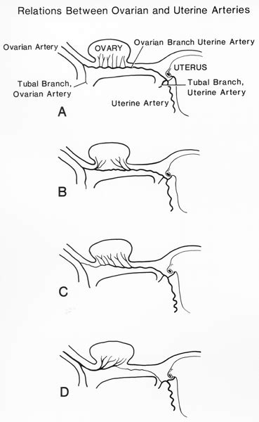 Uterine Arteries Anatomy