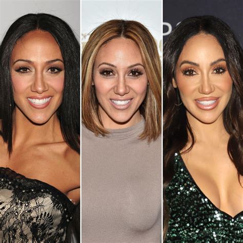 Rhonj Star Melissa Gorga Has Undergone Multiple Plastic Surgery