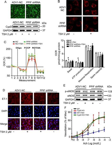 Genetic CypD Knockdown Attenuated TSH Induced MitoOS And Endothelial