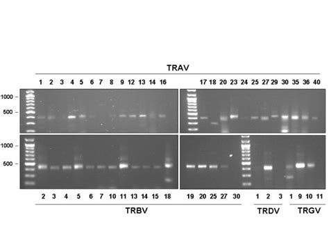 Primer Validation By Rt Pcr All For Primers Listed In Table 1 Were