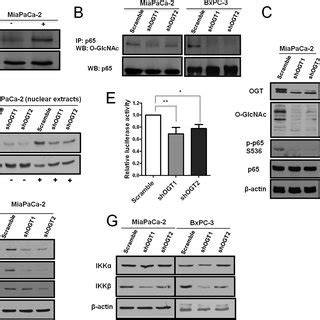 Reducing Hyper O GlcNAcylation Inhibits PDAC Cell Proliferation And