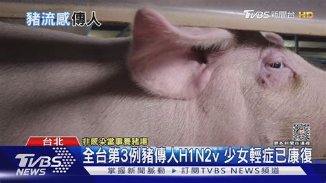 全台第3例豬傳人h1n2v 少女輕症已康復｜tvbs新聞 Tvbsnews01 Youtube