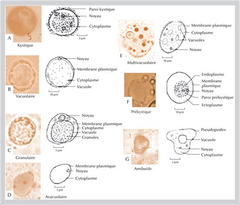 รายการ 98 ภาพ Blastocystis Hominis การ รักษา ความละเอียด 2k 4k