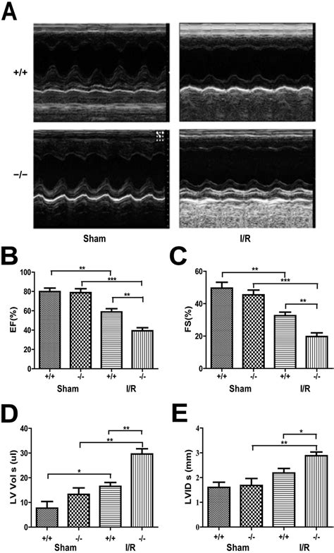 Plin5 Deficiency Aggravates Heart Dysfunction Following I R Injury A