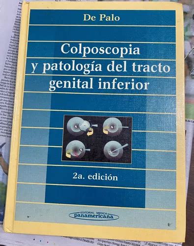 Colposcopia Y Patología Del Tracto Genital Inferior De Palo Mebuscar