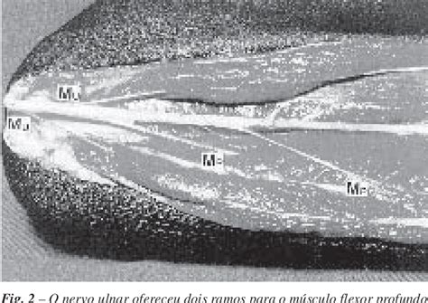 Figure From Estudo Anat Mico Dos Ramos Do Nervo Ulnar Para O M Sculo