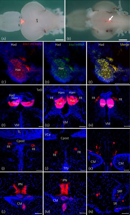 Localisation Of Kiss Expression In The Adult Kiss Mcherry Zebrafish