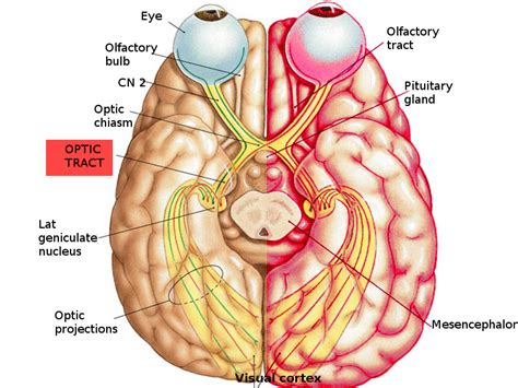 Figure Optic Tract Pathway Image Courtesy S Bhimji MD StatPearls