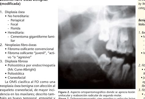 Pdf Fibroma Osificante De Mandibula Presentacion De Un Caso Semantic Scholar