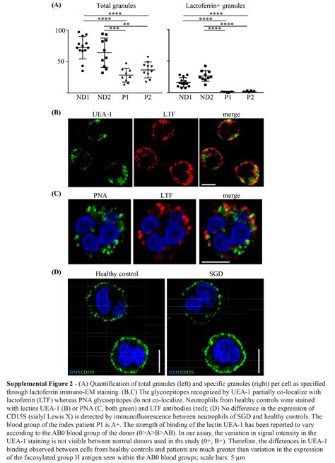 CEBPE Mutant Specific Granule Deficiency Correlates With Aberrant