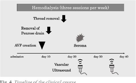 Figure 5 from Seroma as a Rare Complication of Autologous Arteriovenous ...