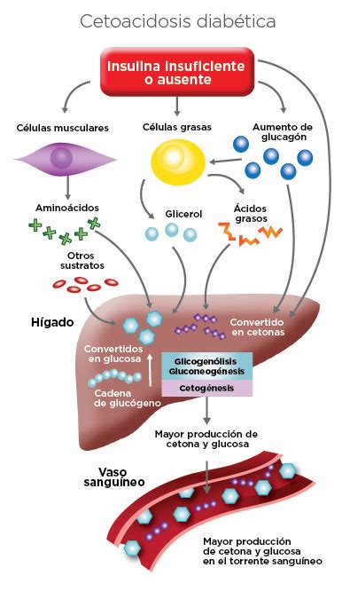 CetogÉnesis Cetoacidosis DiabÉtica