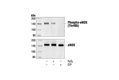 Phospho Enos Thr Antibody L