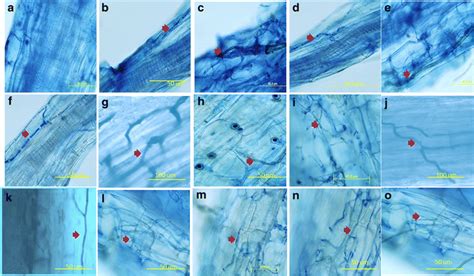 Detection Of Endophytic Fungal Structures Between And Within Root Cells