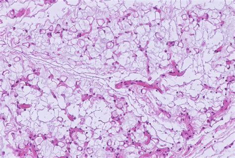 Felipe Dalmeida On Twitter Starvation Induced Fat Atrophy