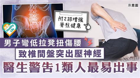 筋骨痛症｜男子彎低拉凳扭傷腰 致椎間盤突出壓神經 醫生警告1類人最易出事 晴報 健康 筋骨痛症 D230226