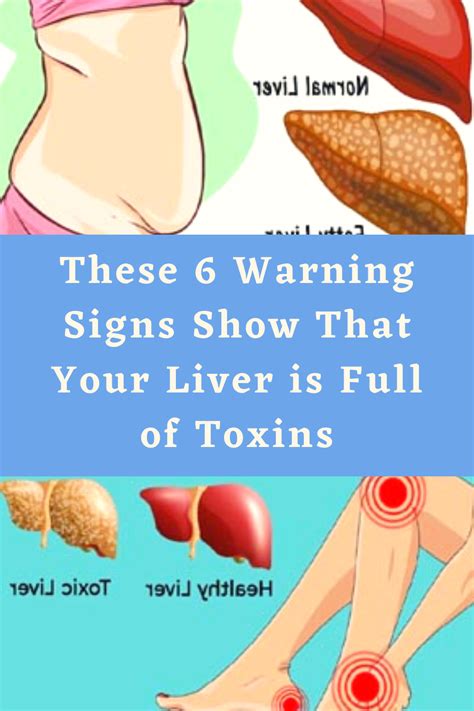 These 6 Warning Signs Show That Your Liver Is Full Of Toxins