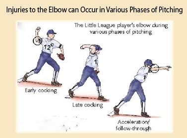 Little League Elbow - Childhood Overuse Injury - Apophysitis