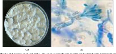 Figure 1 from Entomopathogenic microbes naturally infecting whitefly, Bemisia tabaci (Genn ...